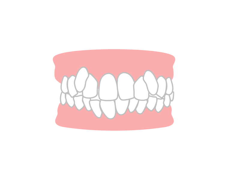 デコボコしている