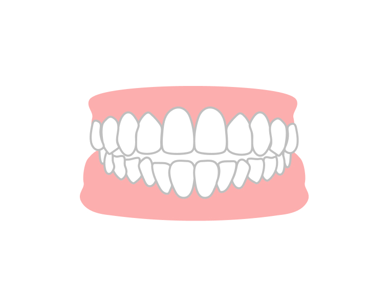 口が閉まらない